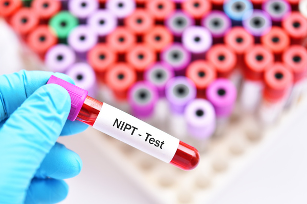 Blood sample for NIPT or Non Invasive Prenatal Testing, diagnosis for fetal Down syndrome in pregnancy woman