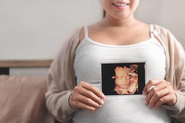 胎児ドック、4D画像の写真を持つ妊婦