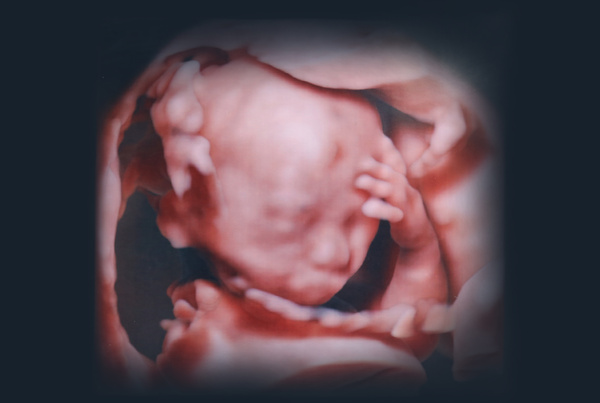 胎児の3D写真、表情がわかる