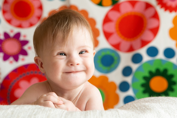 笑顔のダウン症の赤ちゃん