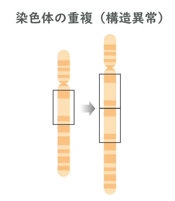 染色体の重複（構造異常）