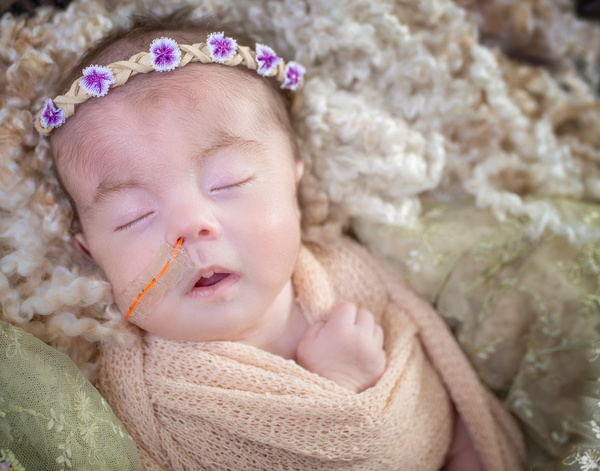 経鼻胃管栄養のチューブを付けたまま眠っている18トリソミーの新生児