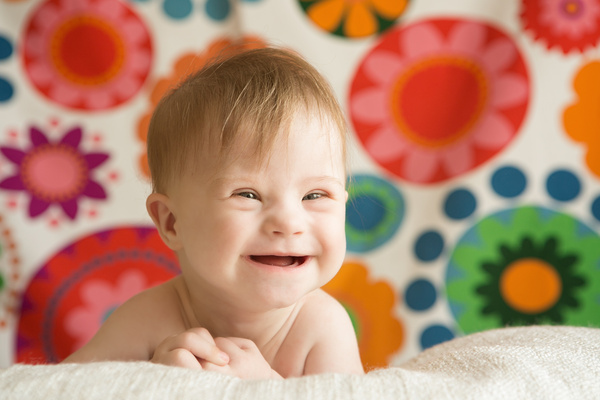 笑顔のダウン症の新生児
