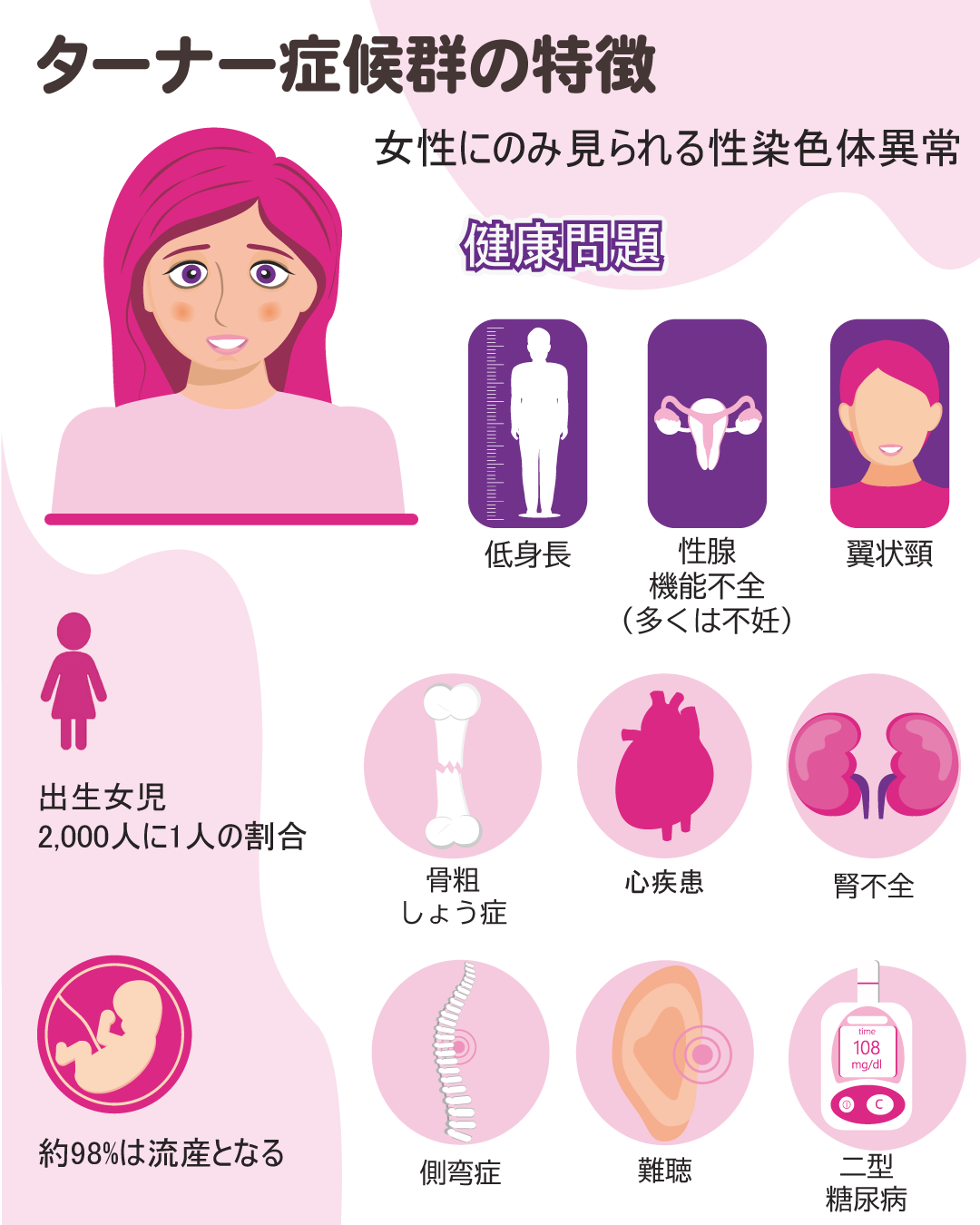 女性におこるターナー症候群とは？ - 新型出生前診断 NIPT Japan