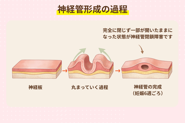 神経管形成の過程