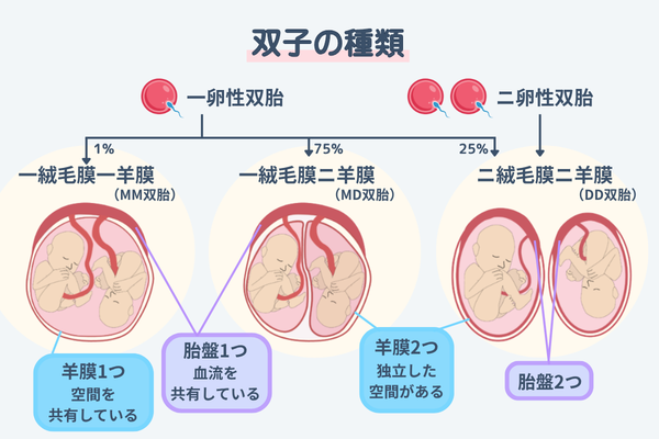 双子の種類（膜性による分類）